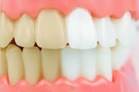 Liquide dentifrice contre la mauvaise haleine
